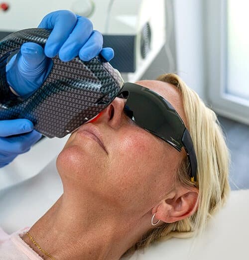 A woman is receiving individual laser treatments.